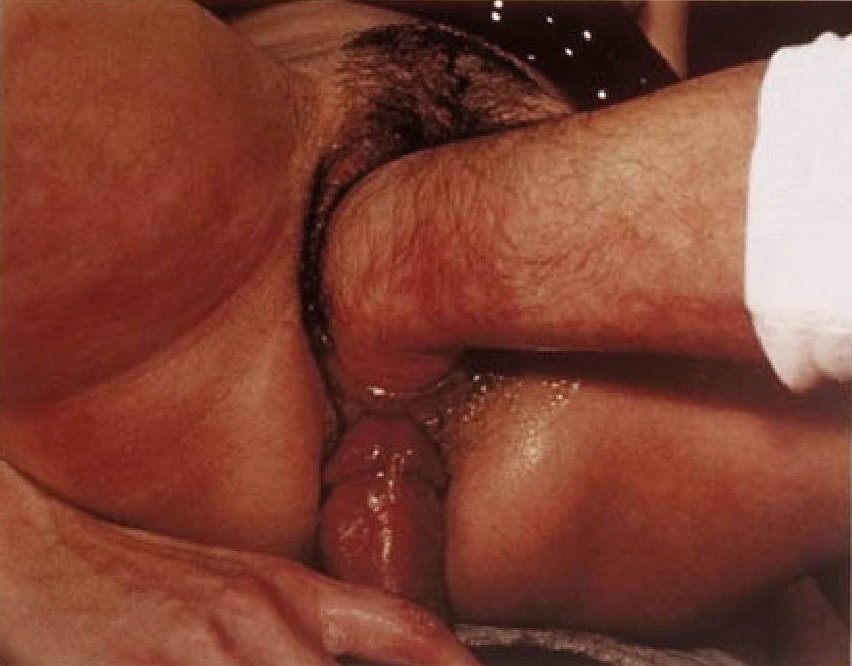 Vintage fist — 5